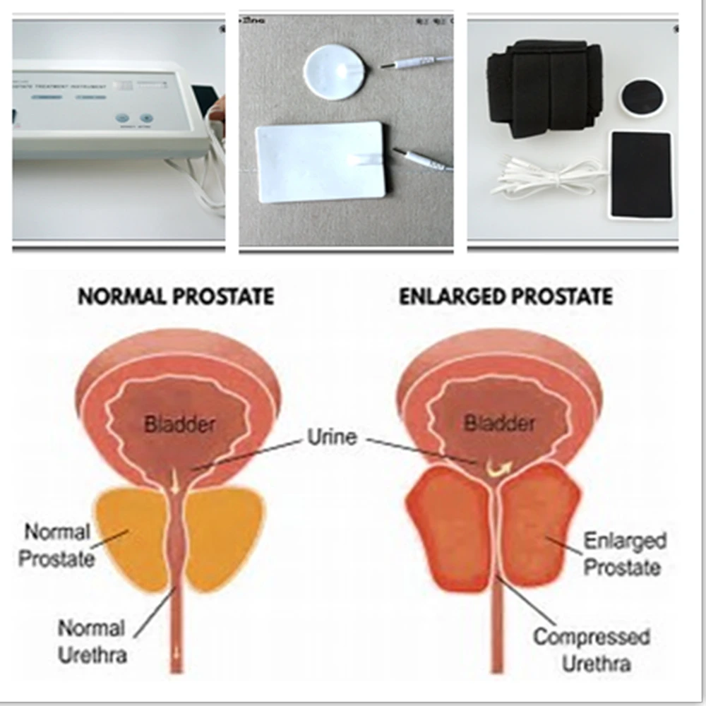 Krachtige prostaatmassager met - Therapy Health And Wellness recensie en prijs